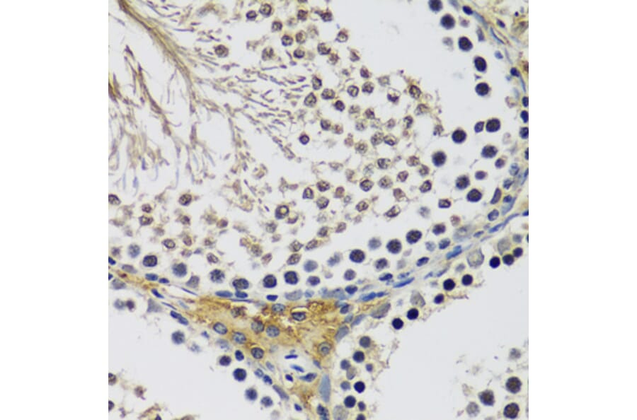 Immunohistochemistry - Anti-C10orf62 Antibody (A17284) - Antibodies.com