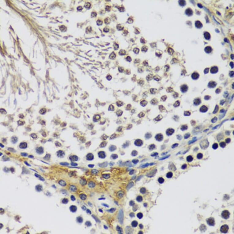 Immunohistochemistry - Anti-C10orf62 Antibody (A17284) - Antibodies.com