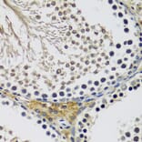 Immunohistochemistry - Anti-C10orf62 Antibody (A17284) - Antibodies.com
