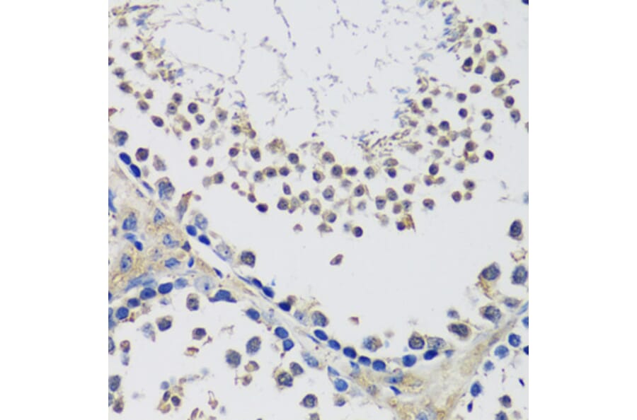 Immunohistochemistry - Anti-C10orf62 Antibody (A17284) - Antibodies.com