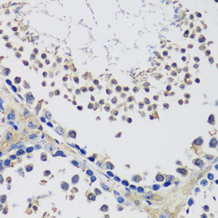 Immunohistochemistry - Anti-C10orf62 Antibody (A17284) - Antibodies.com