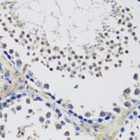Immunohistochemistry - Anti-C10orf62 Antibody (A17284) - Antibodies.com