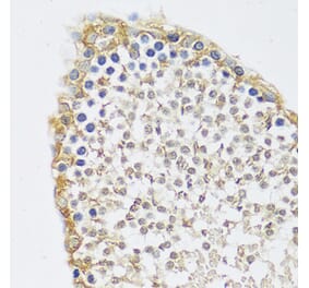 Immunohistochemistry - Anti-C12orf10 Antibody (A92556) - Antibodies.com