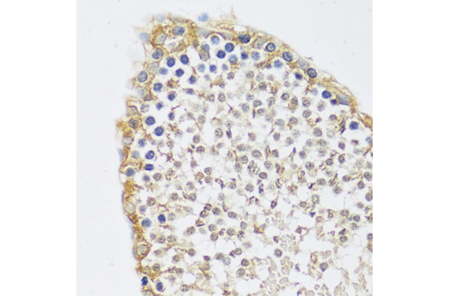 Immunohistochemistry - Anti-C12orf10 Antibody (A92556) - Antibodies.com