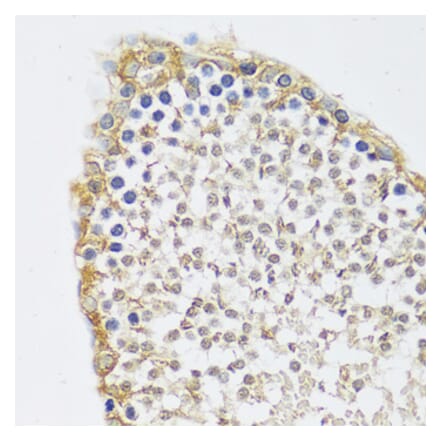 Immunohistochemistry - Anti-C12orf10 Antibody (A92556) - Antibodies.com