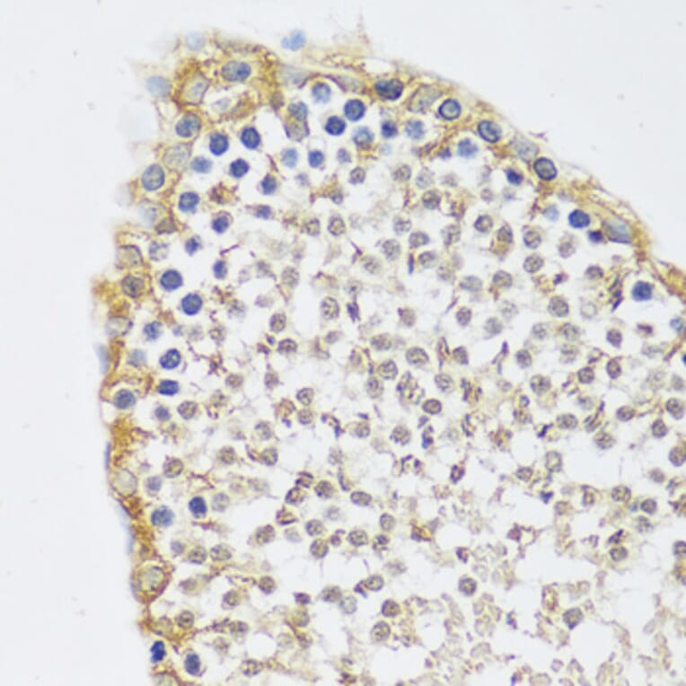 Immunohistochemistry - Anti-C12orf10 Antibody (A92556) - Antibodies.com