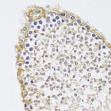 Immunohistochemistry - Anti-C12orf10 Antibody (A92556) - Antibodies.com