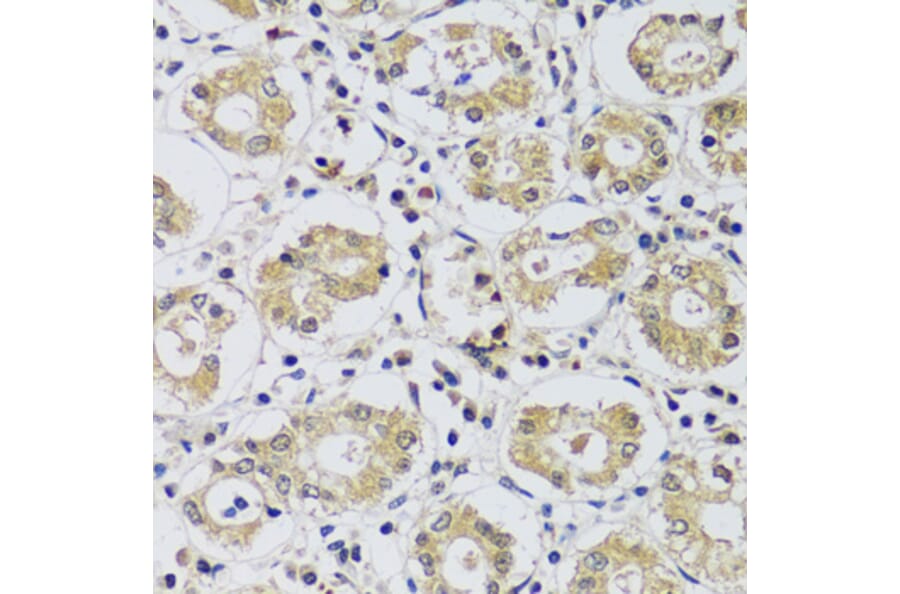 Immunohistochemistry - Anti-C12orf10 Antibody (A92556) - Antibodies.com