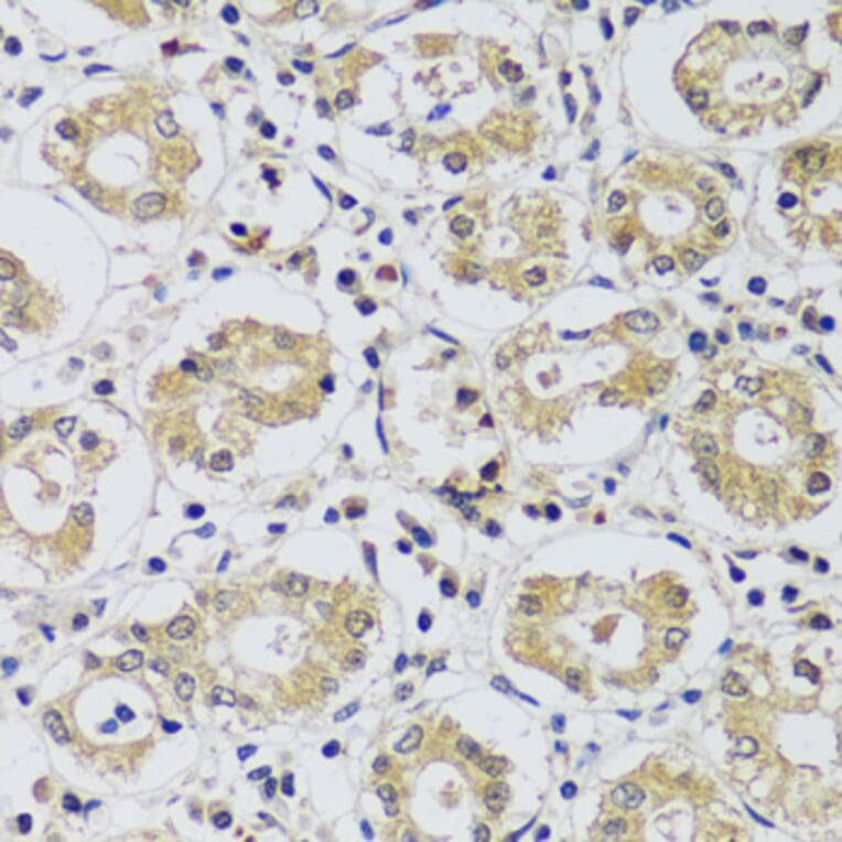 Immunohistochemistry - Anti-C12orf10 Antibody (A92556) - Antibodies.com