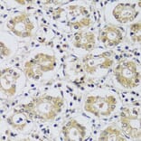 Immunohistochemistry - Anti-C12orf10 Antibody (A92556) - Antibodies.com