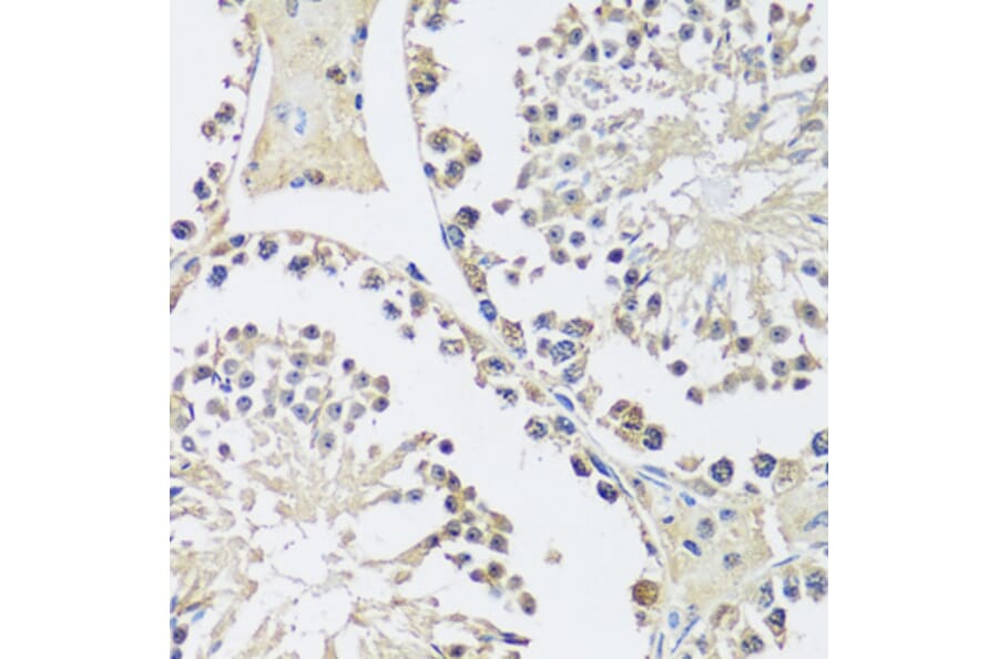 Immunohistochemistry - Anti-C12orf10 Antibody (A92556) - Antibodies.com