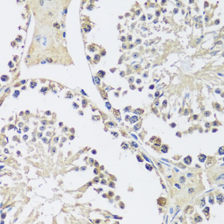 Immunohistochemistry - Anti-C12orf10 Antibody (A92556) - Antibodies.com