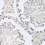 Immunohistochemistry - Anti-C12orf10 Antibody (A92556) - Antibodies.com