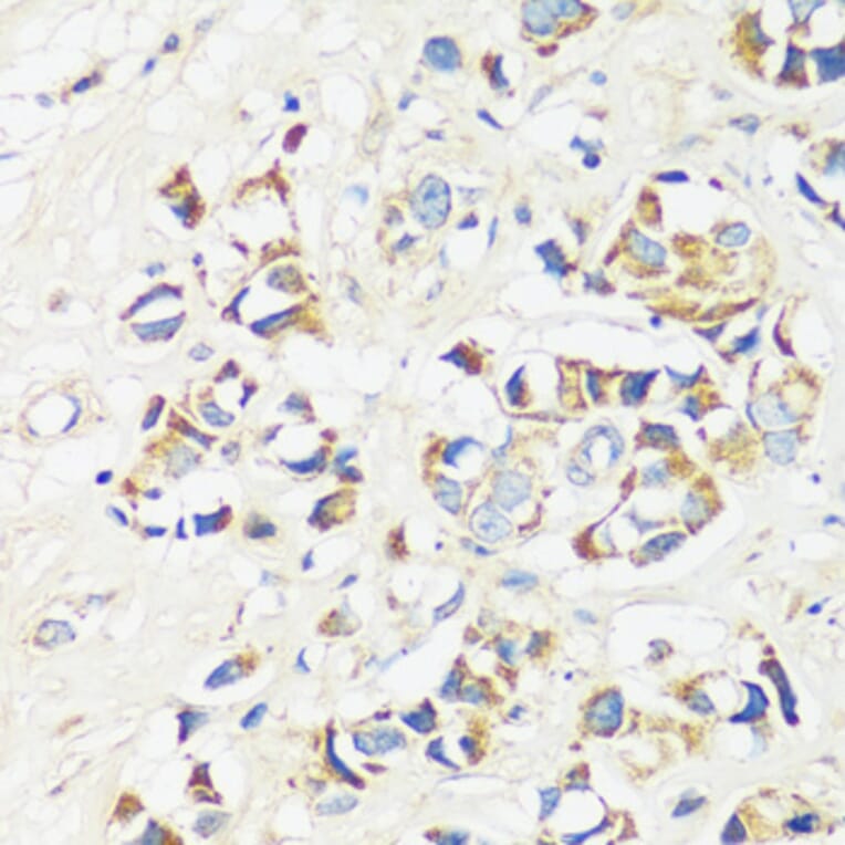Immunohistochemistry - Anti-CAPS1 Antibody (A92557) - Antibodies.com