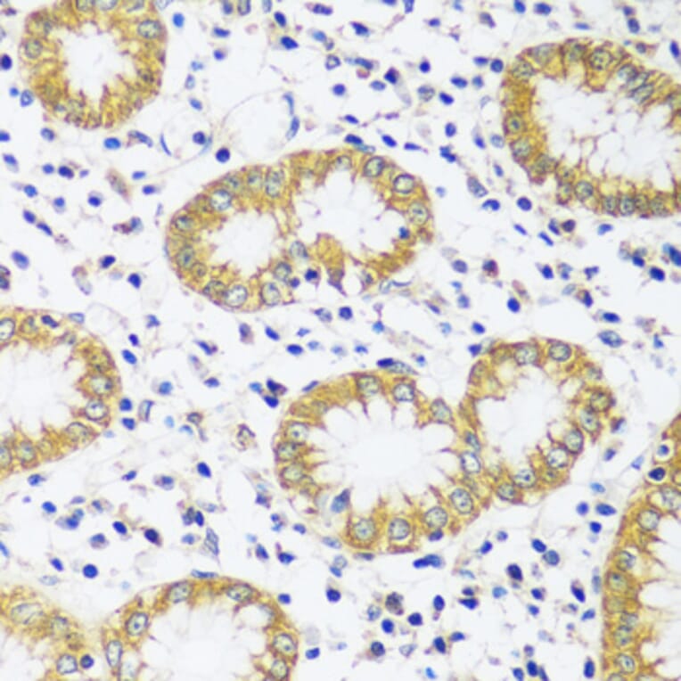 Immunohistochemistry - Anti-CAPS1 Antibody (A92557) - Antibodies.com
