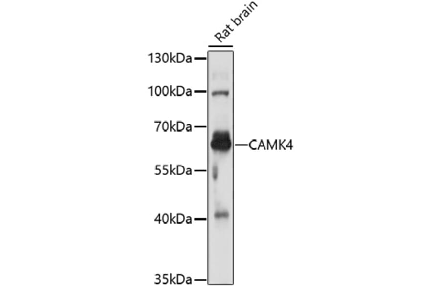 Western Blot - Anti-CAMK4 Antibody (A16787) - Antibodies.com