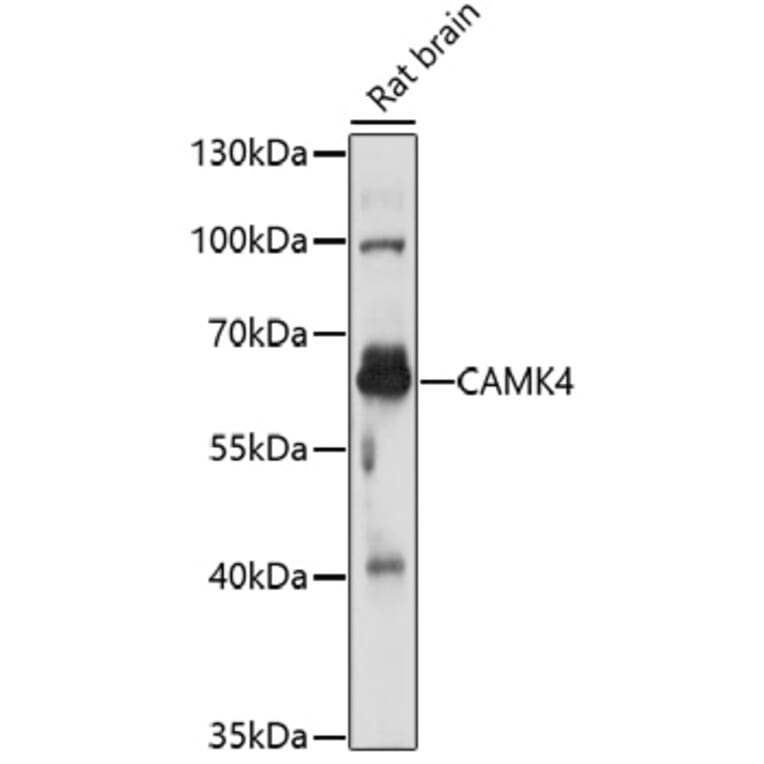 Western Blot - Anti-CAMK4 Antibody (A16787) - Antibodies.com