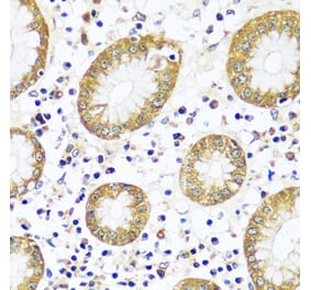 Immunohistochemistry - Anti-Calpain 9 Antibody (A92559) - Antibodies.com