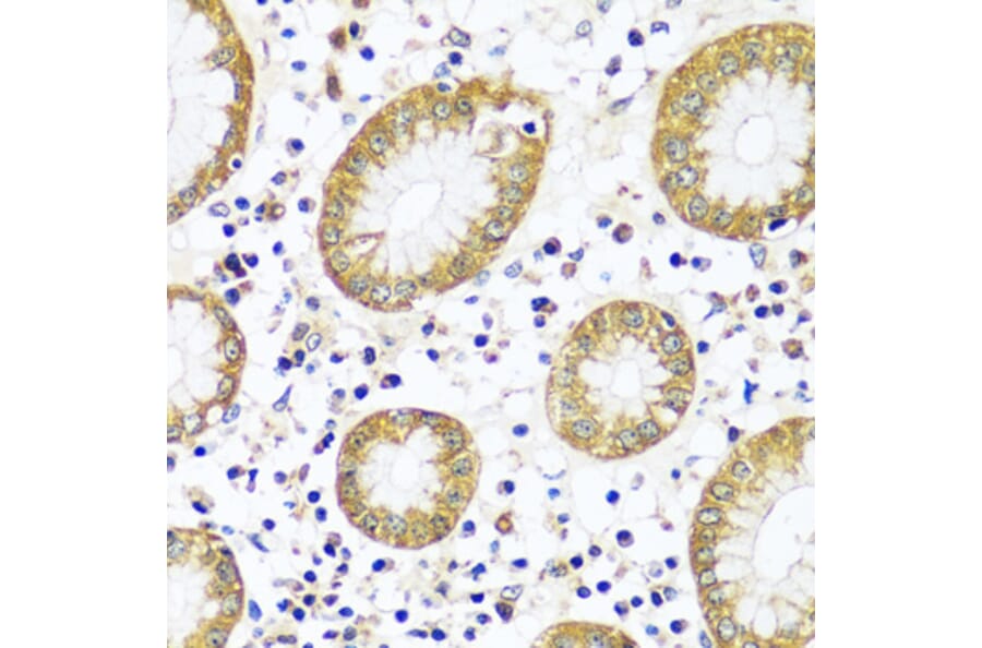 Immunohistochemistry - Anti-Calpain 9 Antibody (A92559) - Antibodies.com