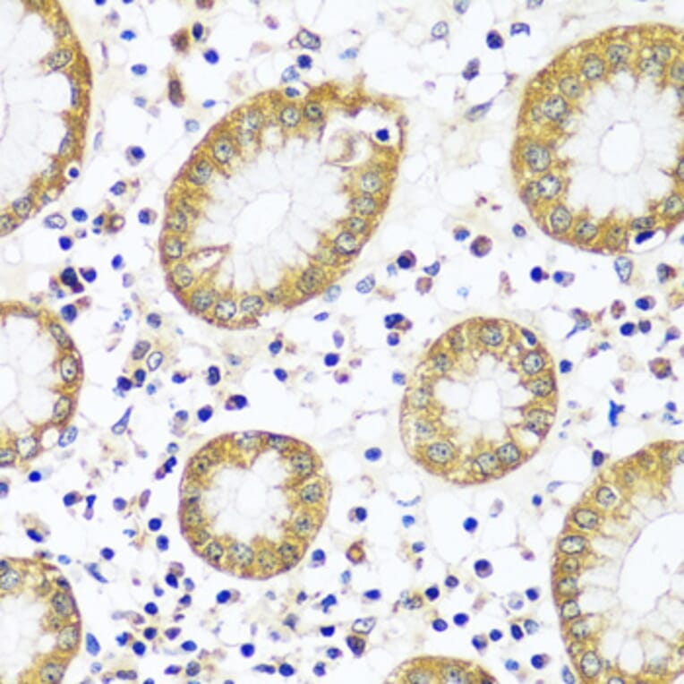 Immunohistochemistry - Anti-Calpain 9 Antibody (A92559) - Antibodies.com