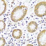 Immunohistochemistry - Anti-Calpain 9 Antibody (A92559) - Antibodies.com