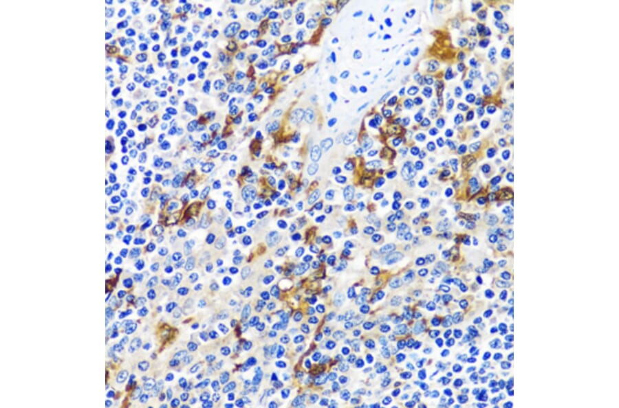 Immunohistochemistry - Anti-CASQ1 Antibody (A16796) - Antibodies.com