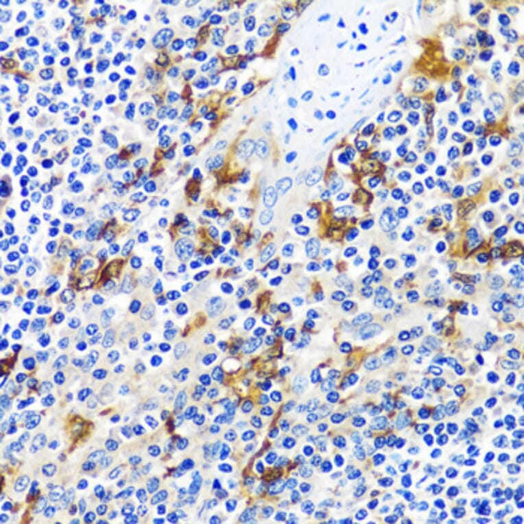 Immunohistochemistry - Anti-CASQ1 Antibody (A16796) - Antibodies.com