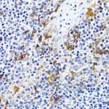 Immunohistochemistry - Anti-CASQ1 Antibody (A16796) - Antibodies.com