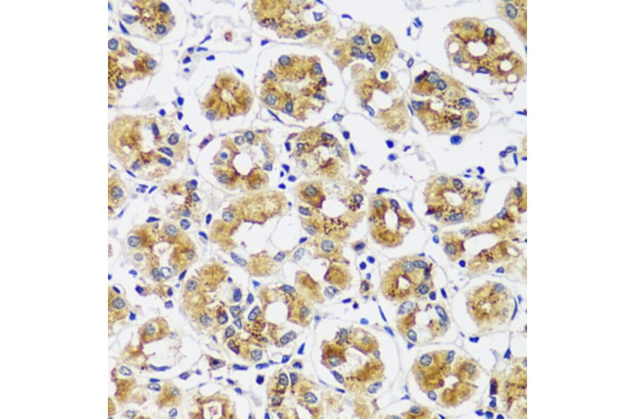 Immunohistochemistry - Anti-CASQ1 Antibody (A16796) - Antibodies.com