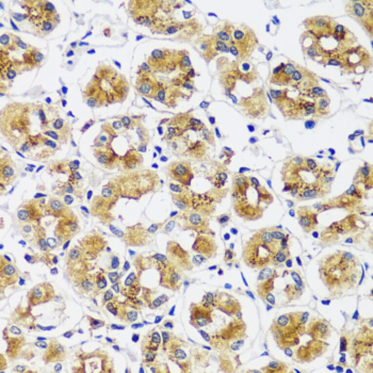 Immunohistochemistry - Anti-CASQ1 Antibody (A16796) - Antibodies.com