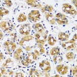 Immunohistochemistry - Anti-CASQ1 Antibody (A16796) - Antibodies.com
