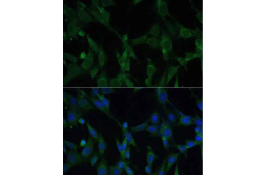 Immunofluorescence - Anti-CASQ1 Antibody (A16796) - Antibodies.com