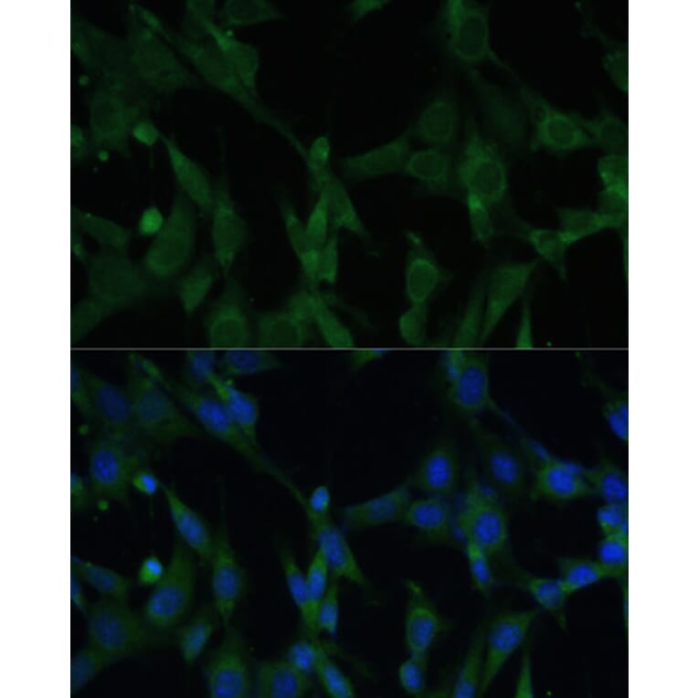 Immunofluorescence - Anti-CASQ1 Antibody (A16796) - Antibodies.com