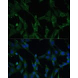 Immunofluorescence - Anti-CASQ1 Antibody (A16796) - Antibodies.com