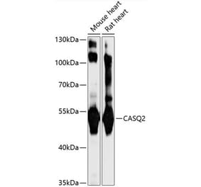 Western Blot - Anti-Calsequestrin 2 Antibody (A92562) - Antibodies.com