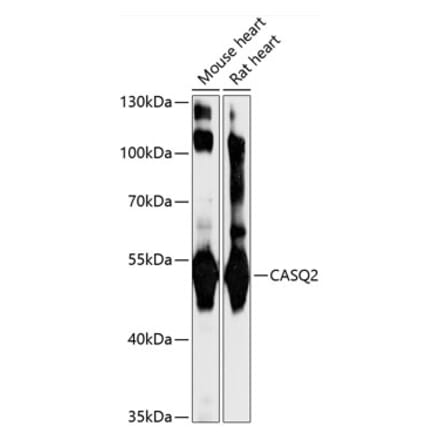 Western Blot - Anti-Calsequestrin 2 Antibody (A92562) - Antibodies.com