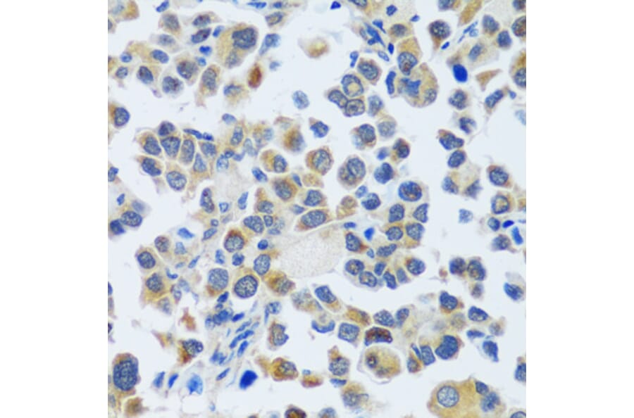 Immunohistochemistry - Anti-CAST Antibody (A16790) - Antibodies.com