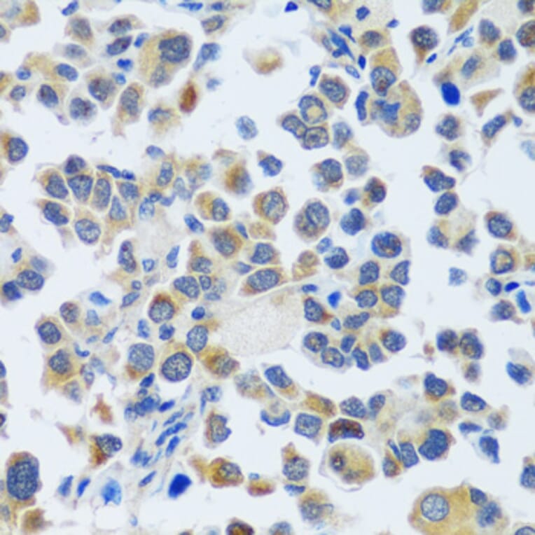 Immunohistochemistry - Anti-CAST Antibody (A16790) - Antibodies.com