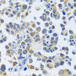 Immunohistochemistry - Anti-CAST Antibody (A16790) - Antibodies.com