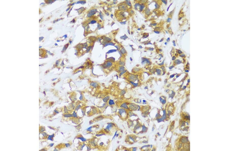 Immunohistochemistry - Anti-CAST Antibody (A16790) - Antibodies.com