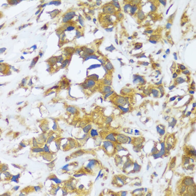 Immunohistochemistry - Anti-CAST Antibody (A16790) - Antibodies.com