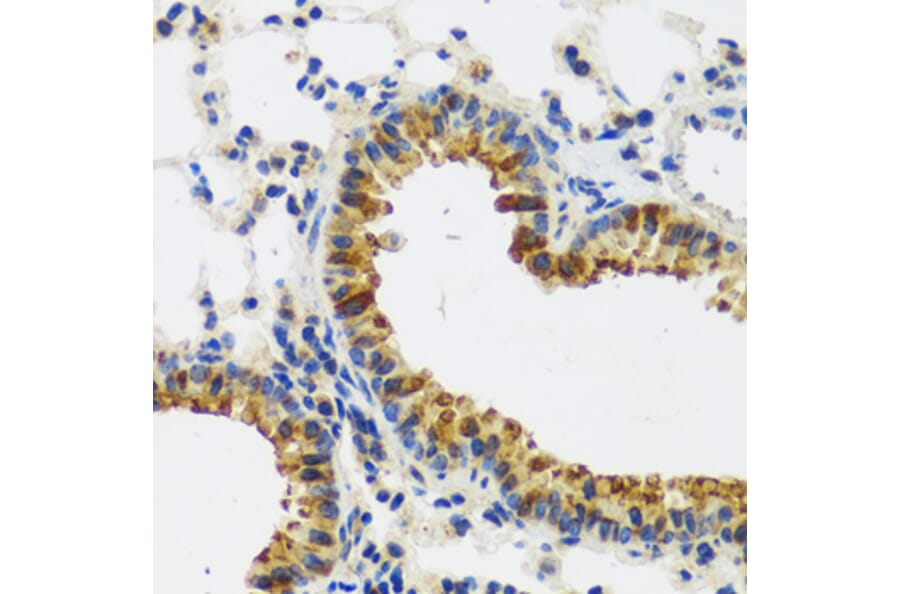 Immunohistochemistry - Anti-CAST Antibody (A16790) - Antibodies.com