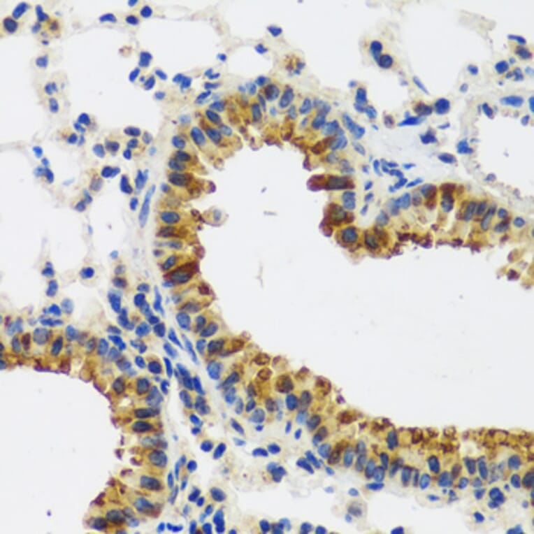 Immunohistochemistry - Anti-CAST Antibody (A16790) - Antibodies.com