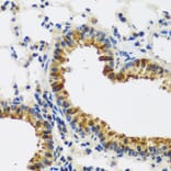Immunohistochemistry - Anti-CAST Antibody (A16790) - Antibodies.com