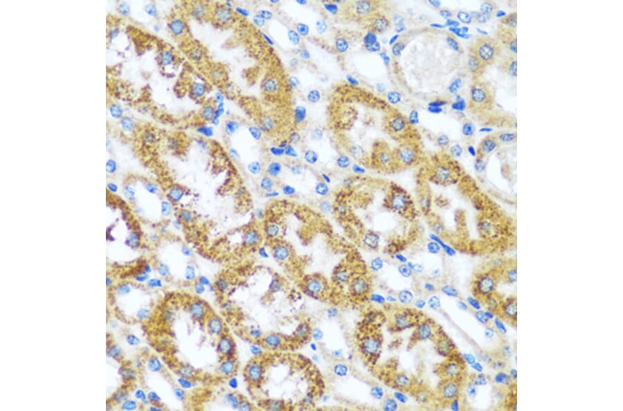 Immunohistochemistry - Anti-CAST Antibody (A16790) - Antibodies.com