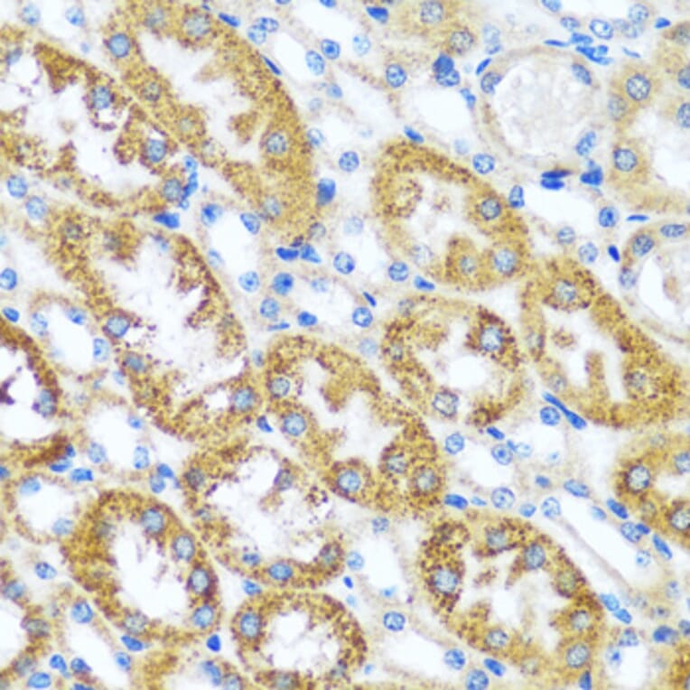 Immunohistochemistry - Anti-CAST Antibody (A16790) - Antibodies.com