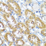 Immunohistochemistry - Anti-CAST Antibody (A16790) - Antibodies.com