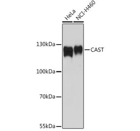 Western Blot - Anti-Calpastatin Antibody (A92564) - Antibodies.com