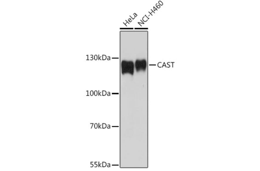 Western Blot - Anti-Calpastatin Antibody (A92564) - Antibodies.com