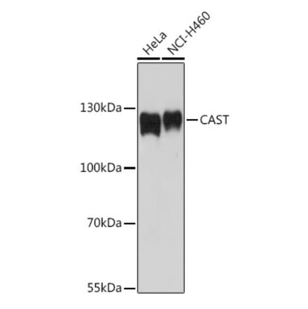 Western Blot - Anti-Calpastatin Antibody (A92564) - Antibodies.com
